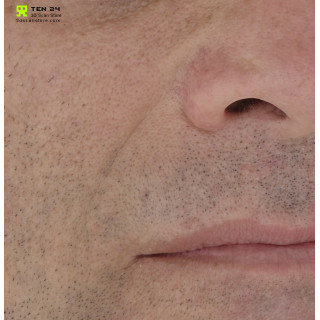 Close Up：Martin Schoellerの顔面図鑑 Close Up：Martin Schoellerの顔面図鑑 Close Up：Martin